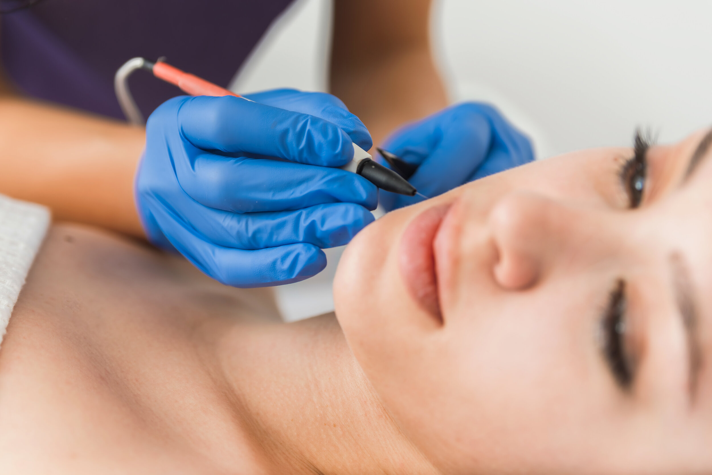 Electrolysis technician performing precise hair removal on a client's face.